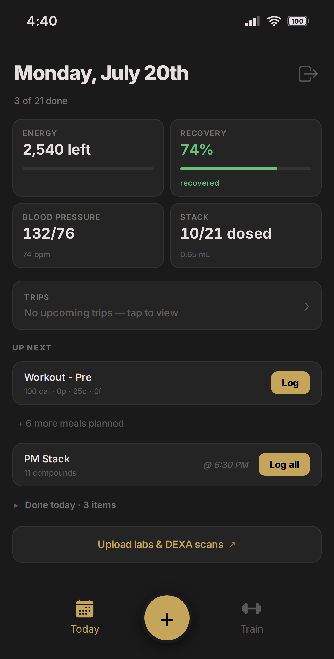 iOS app — Today screen with Up Next queue